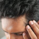 Hair Transplant