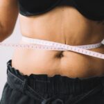 liposuction cost