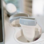 超音波診断装置 価格
